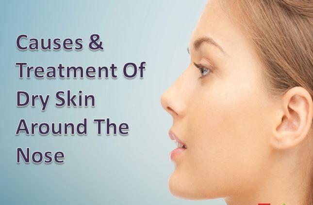 Know The Causes And Treatments Of Dry Skin Around The Nose 