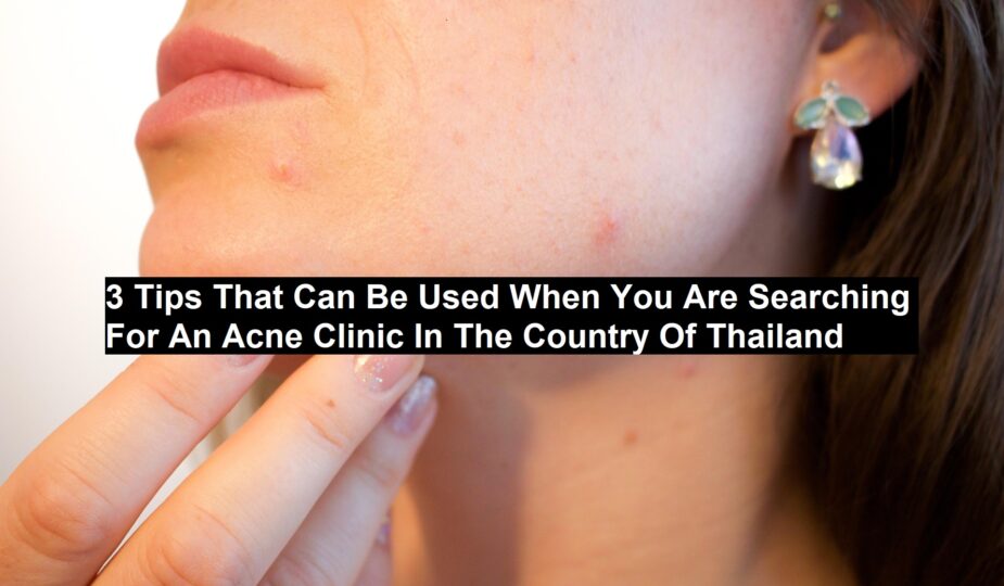 Acne Clinic