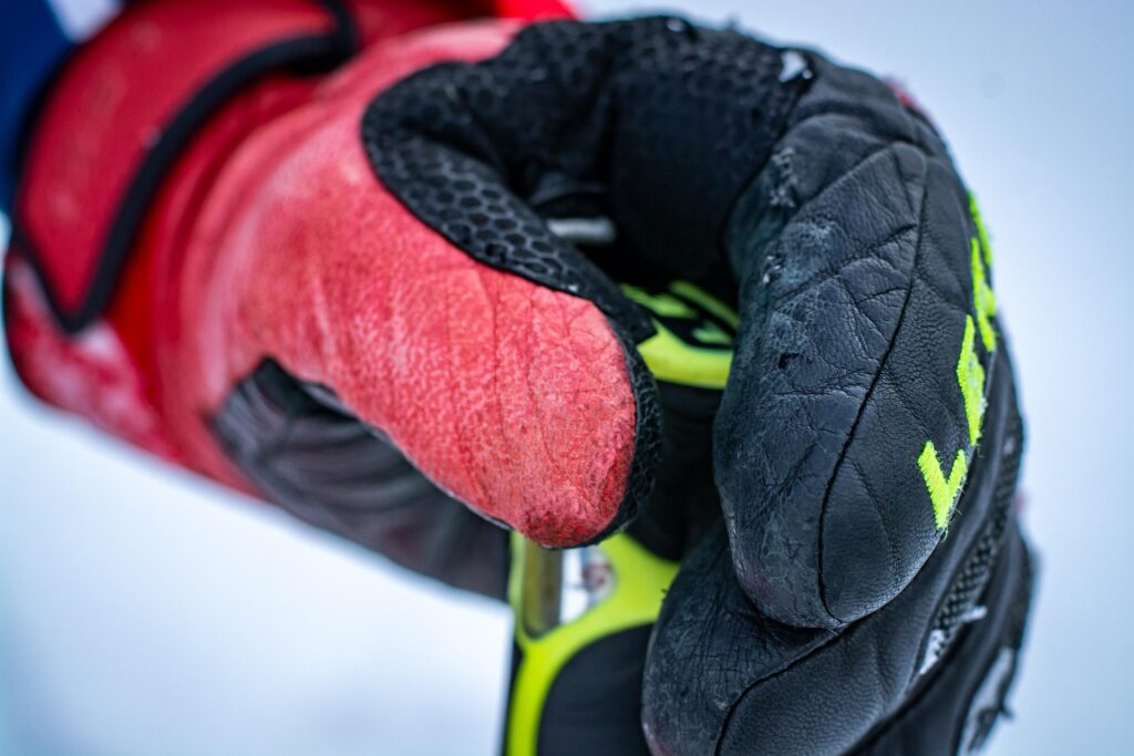 Preventing Frost (and Blisters)