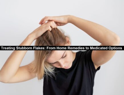 Treating Stubborn Flakes
